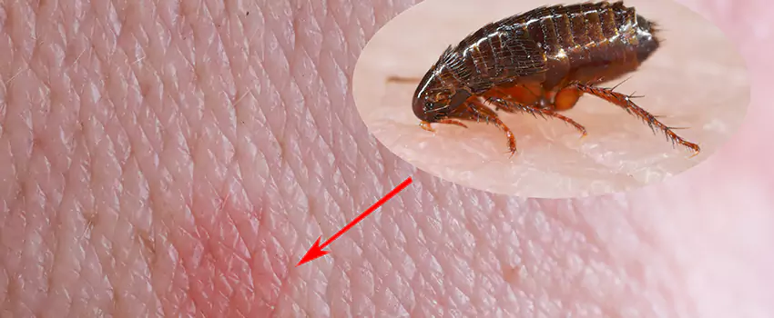 Flea Control for Humans Mission Viejo, CA